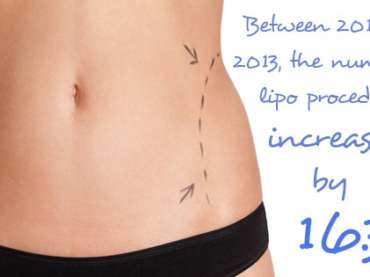 You Might Be Surprised to Learn These 3 Facts About Laser Liposuction