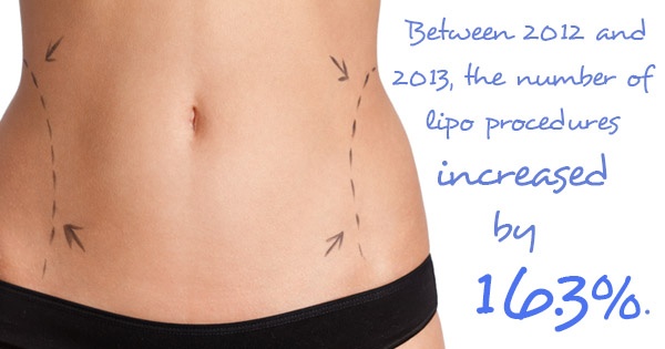 You Might Be Surprised to Learn These 3 Facts About Laser Liposuction
